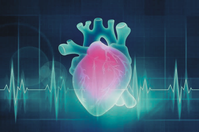 Heart Attack Critical Illness Cover