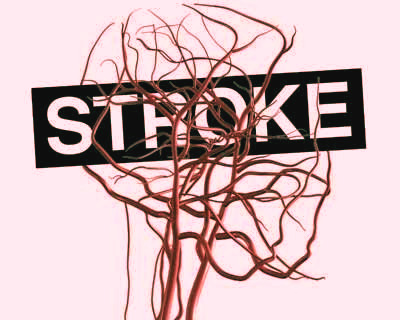 Stroke Critical Illness Cover