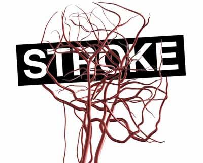 Stroke Critical Illness Cover